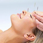 Holistic Acupuncture